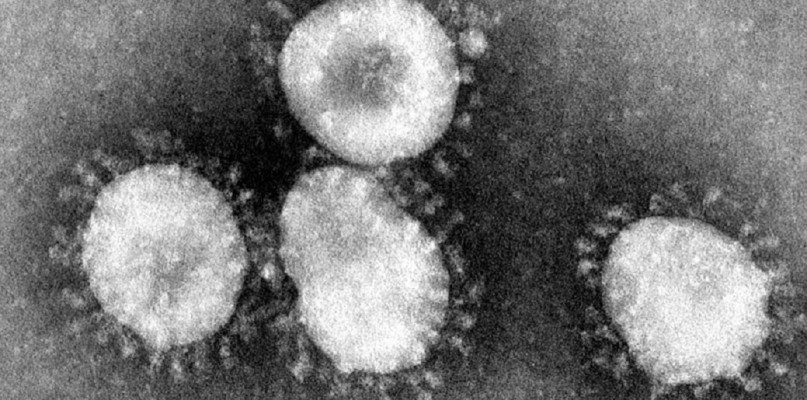 Autor: Content Providers(s): CDC/Dr. Fred Murphy /z: Wikipedia/